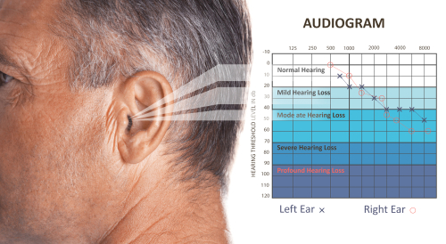 Audiogram